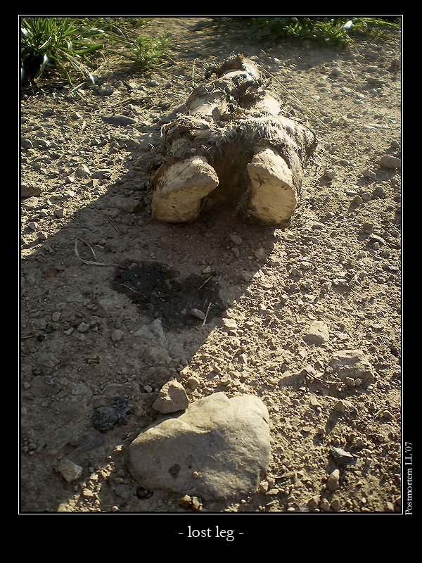 Lost leg